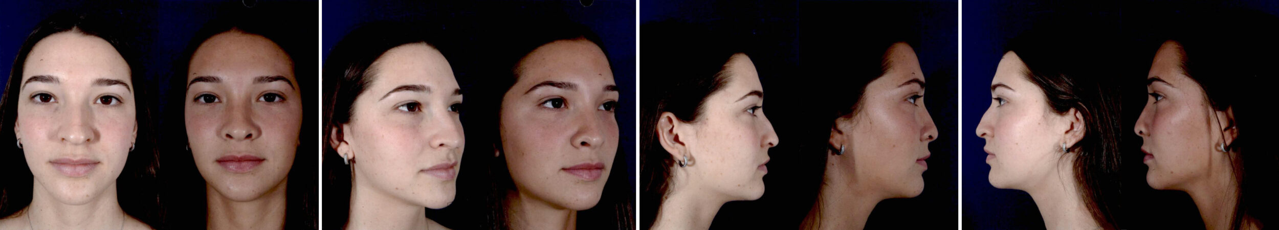 Before and After Image: Patient # 34682 - other