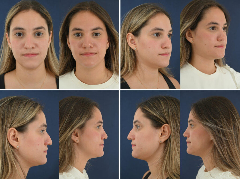 Before and After Image: Patient # 35773 - other