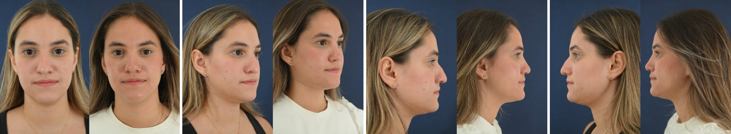 Before and After Image: Patient # 35773 - other