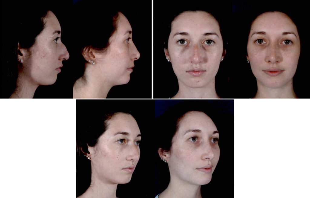 Before and After Image: Patient # 59323 - other