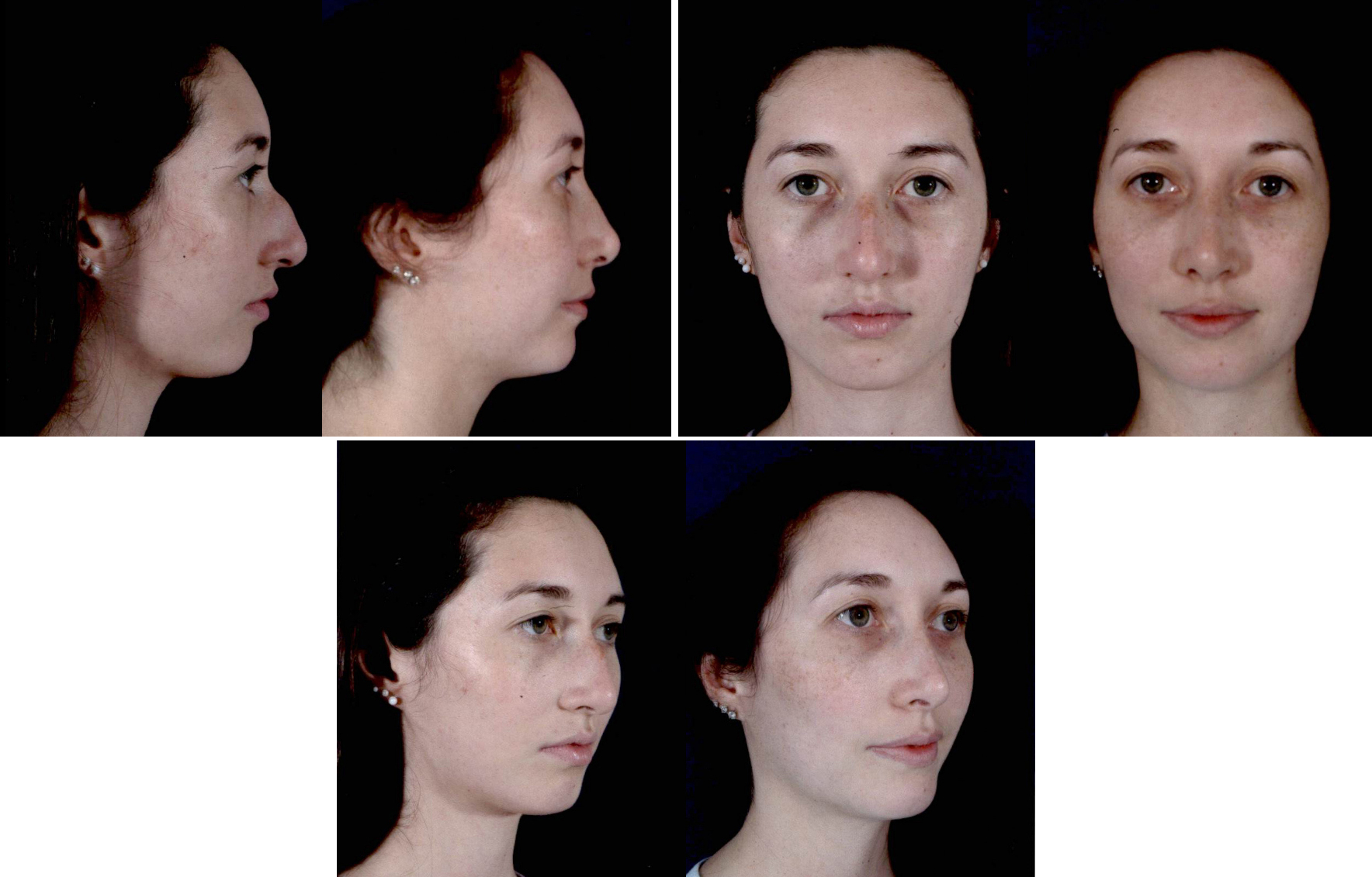 Before and After Image: Patient # 59323 - other