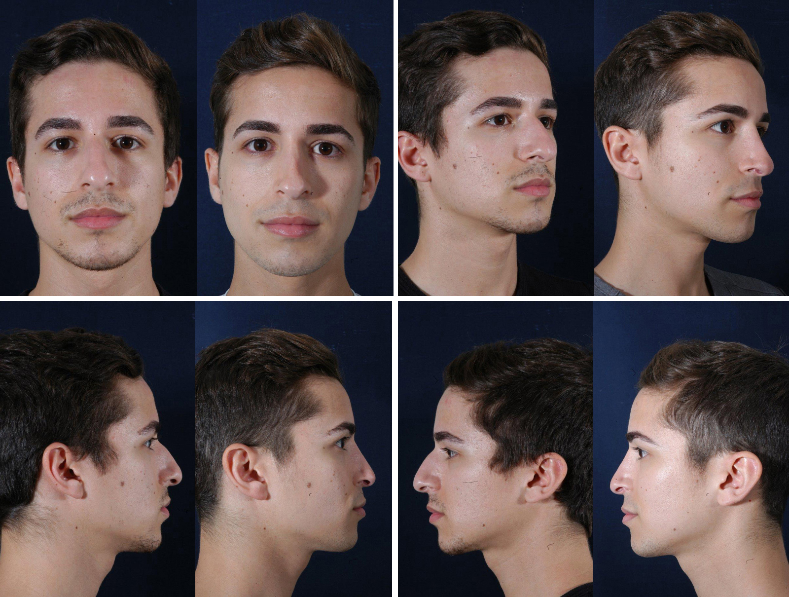 Before and After Image: Patient # 63771 - other