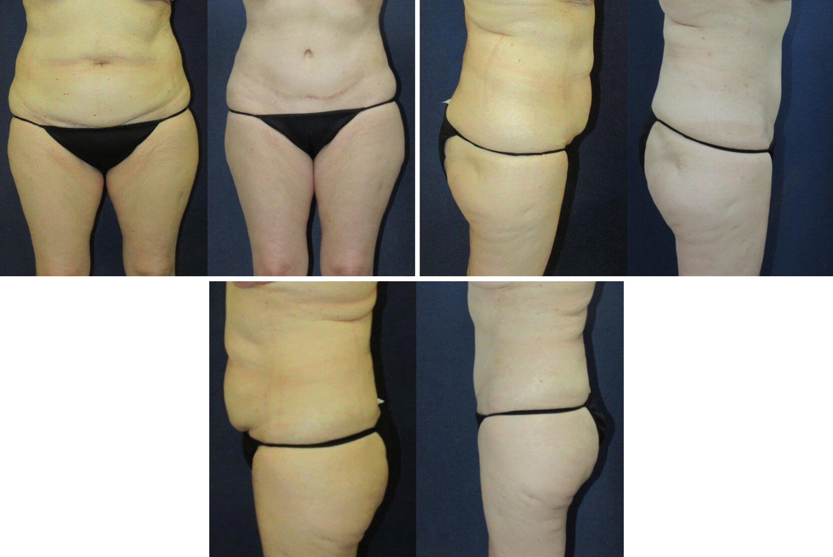 Before and After Image: Patient # 21993 - other